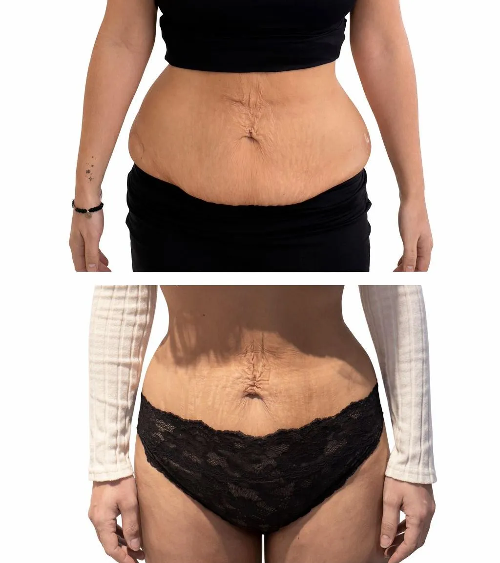 Astra Body — wellness-studio in Eastleigh — 5