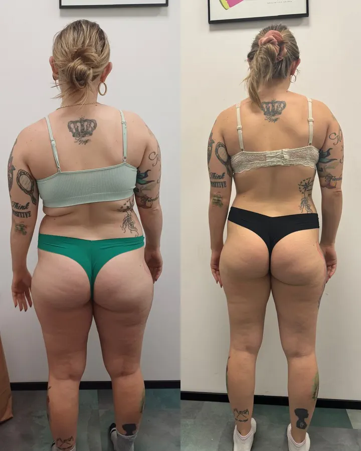 Nutricionista y Entrenador Personal Santiago Del Sur — entrenamiento personal-studio en Abando, Bilbao — 3