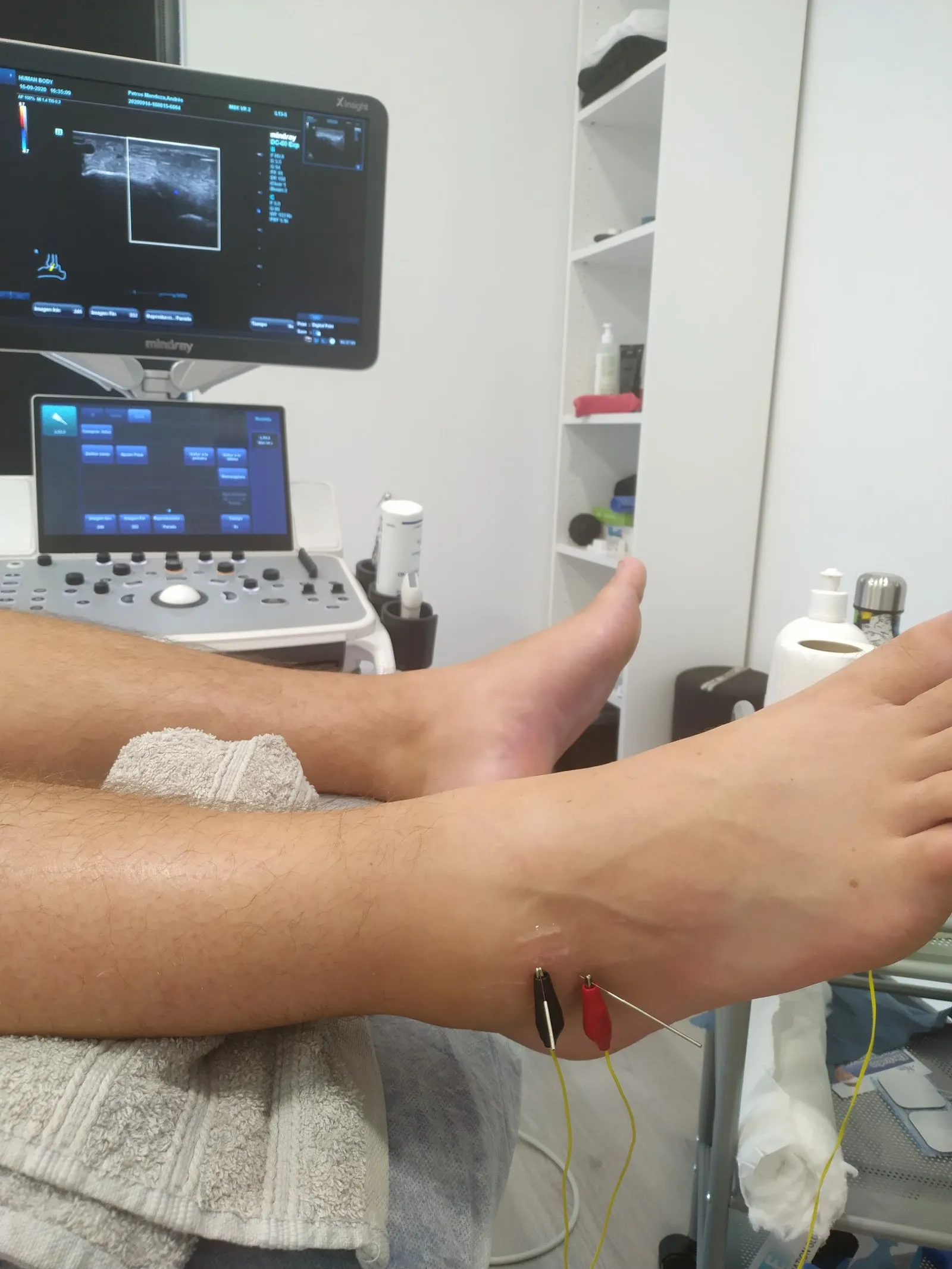 Human Body Fisioterapia — entrenamiento personal-studio en Madrid — 3