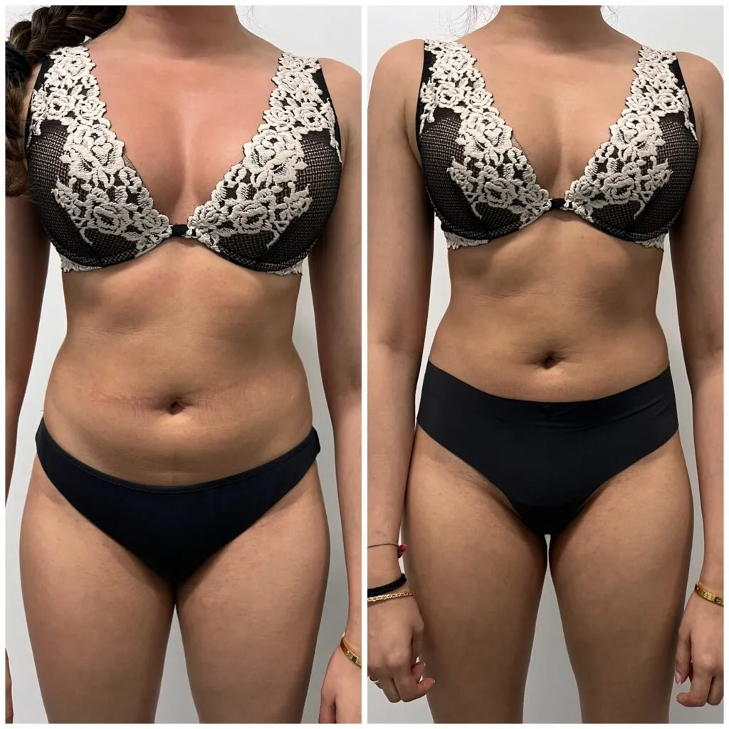 Xbody by Anabela — pt studio in Northampton — 2