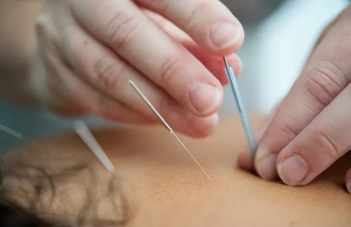 Göteborgs Massage & Rehab - Almedal — pt-studio i Krokslätt, Göteborg — 2