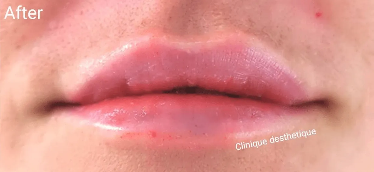 Clinique Désthetique — pilates-studio i Södertälje — bild 4