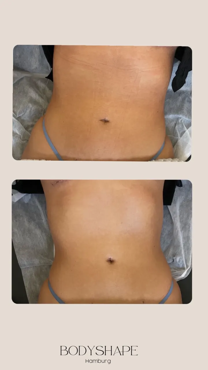 Body Shape — fitnessstudio in Hamburg — 2