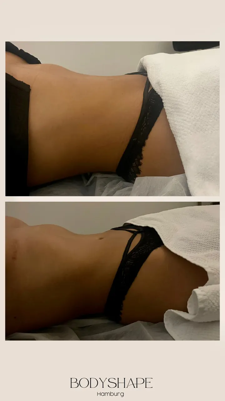 Body Shape — fitnessstudio in Hamburg — 3