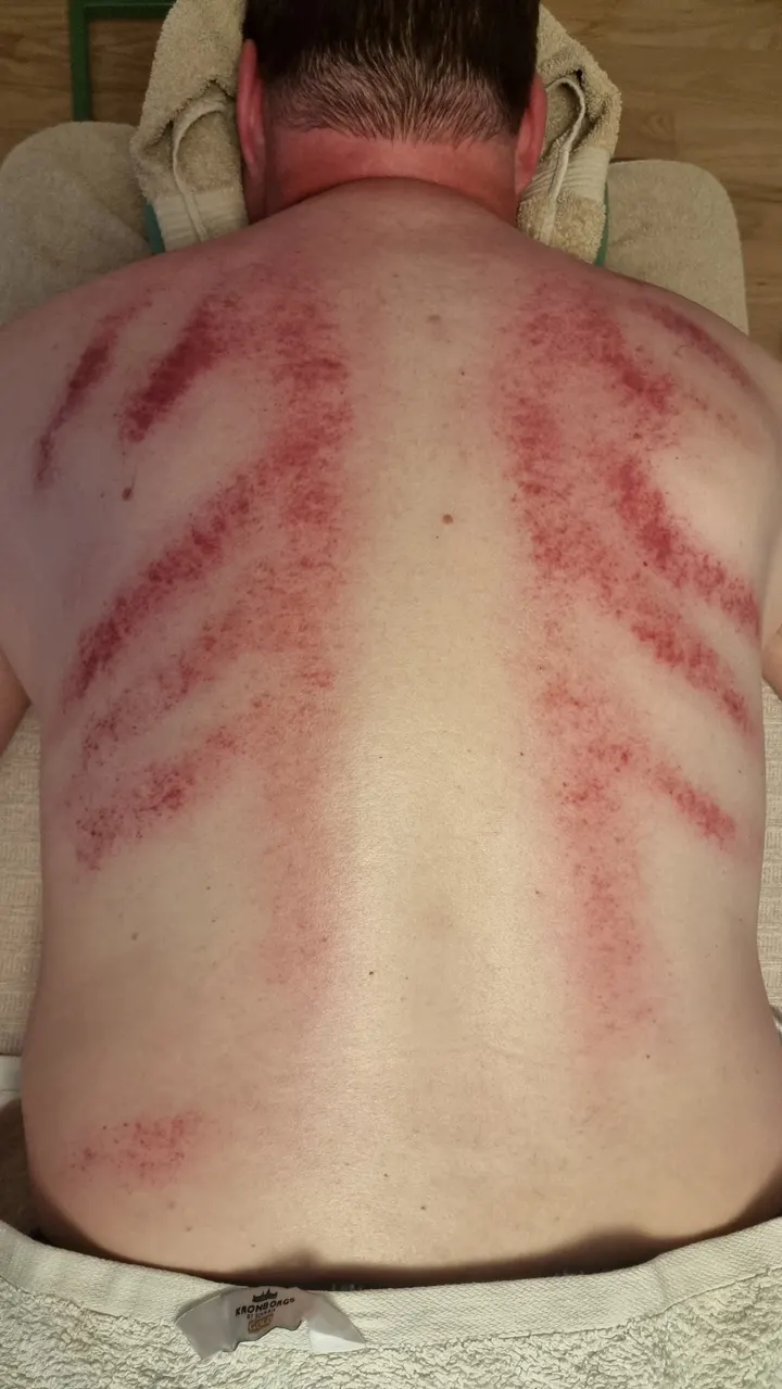 Carina E:s Kroppsterapi AB — wellness-studio i Allarängen och Kärra, Kungsbacka — 3